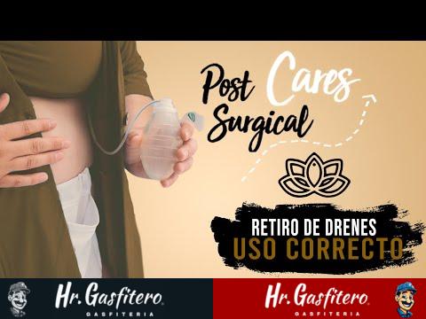 Proceso de retirada de drenajes después de la cirugía abdominal 1 Proceso de retirada de drenajes después de la cirugía abdominal