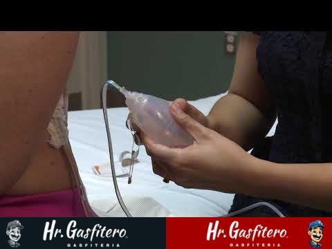 El proceso de drenaje postoperatorio y su importancia en la recuperación. 1 El proceso de drenaje postoperatorio y su importancia en la recuperación.